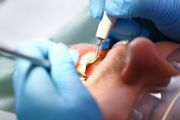 Best Emergency Care for Gum Disease in Cinco Ranch, TX